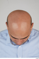  Photos Haazim Yacoub bald head 0006.jpg